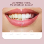 Rechargeable Sonic Electric Toothbrush for Adults 3 | PricZone Rechargeable Sonic Electric Toothbrush for Adults 3 | PricZone