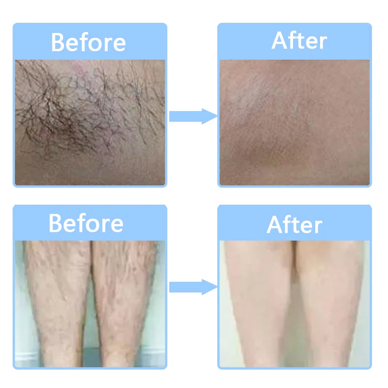 Electric Wax Heater for Hair Removal Paraffin Therapy 6 | PricZone Electric Wax Heater for Hair Removal Paraffin Therapy 6 | PricZone